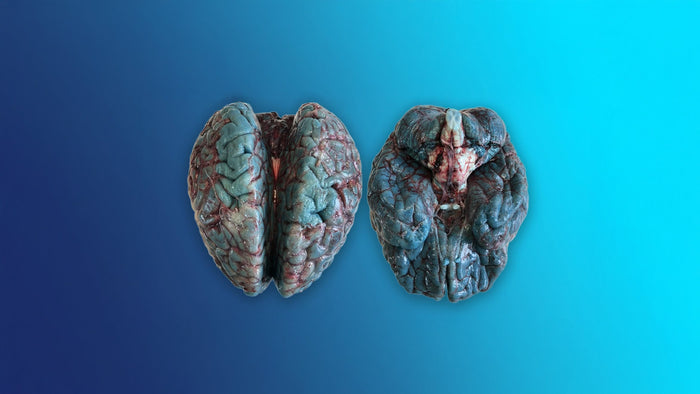 Does Methylene Blue Turn Your Brain Blue blog image showing autopsy brains stained blue from medical methylene blue infusion not supplement use